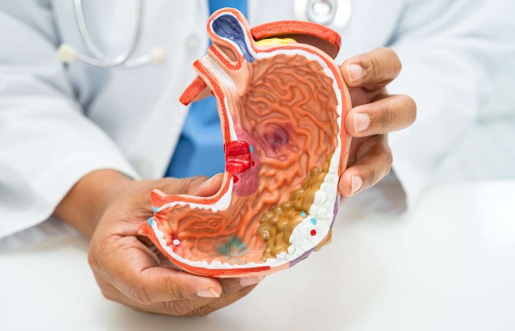 O QUE É TRATAMENTO CIRÚRGICO DA OBESIDADE?